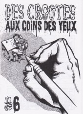 Des croûtes aux coins des yeux -6- Des croûtes aux coins des yeux #6